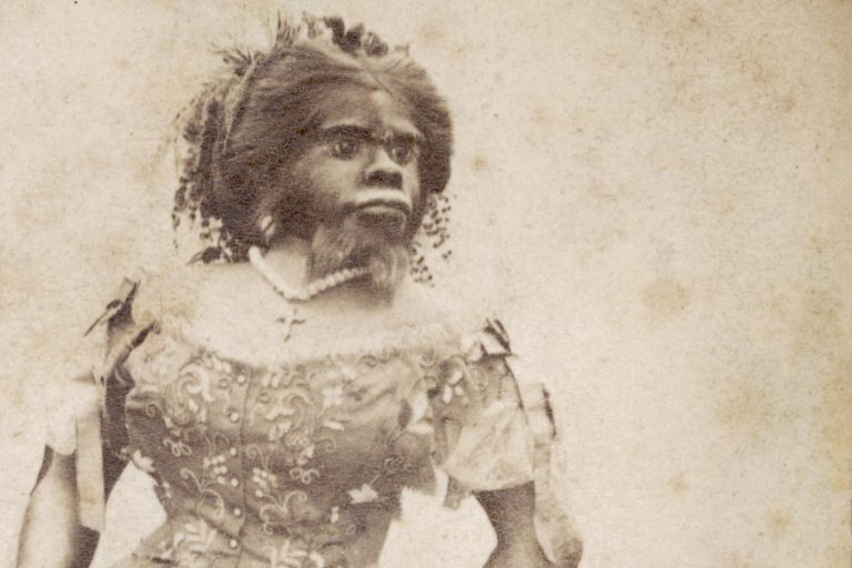 “La mujer más fea del mundo”